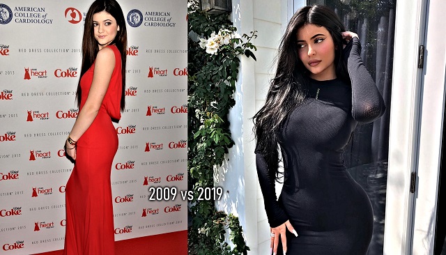 Suspicions Looming: Kylie Jenner’s Rumoured Plastic Surgery