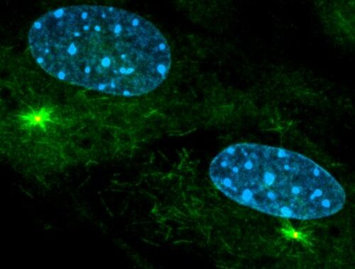 A New Understanding Of The Function Of The NSL Complex In Ciliopathies